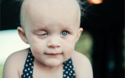 Meet Marlee – Alveolar Rhabdomyosarcoma