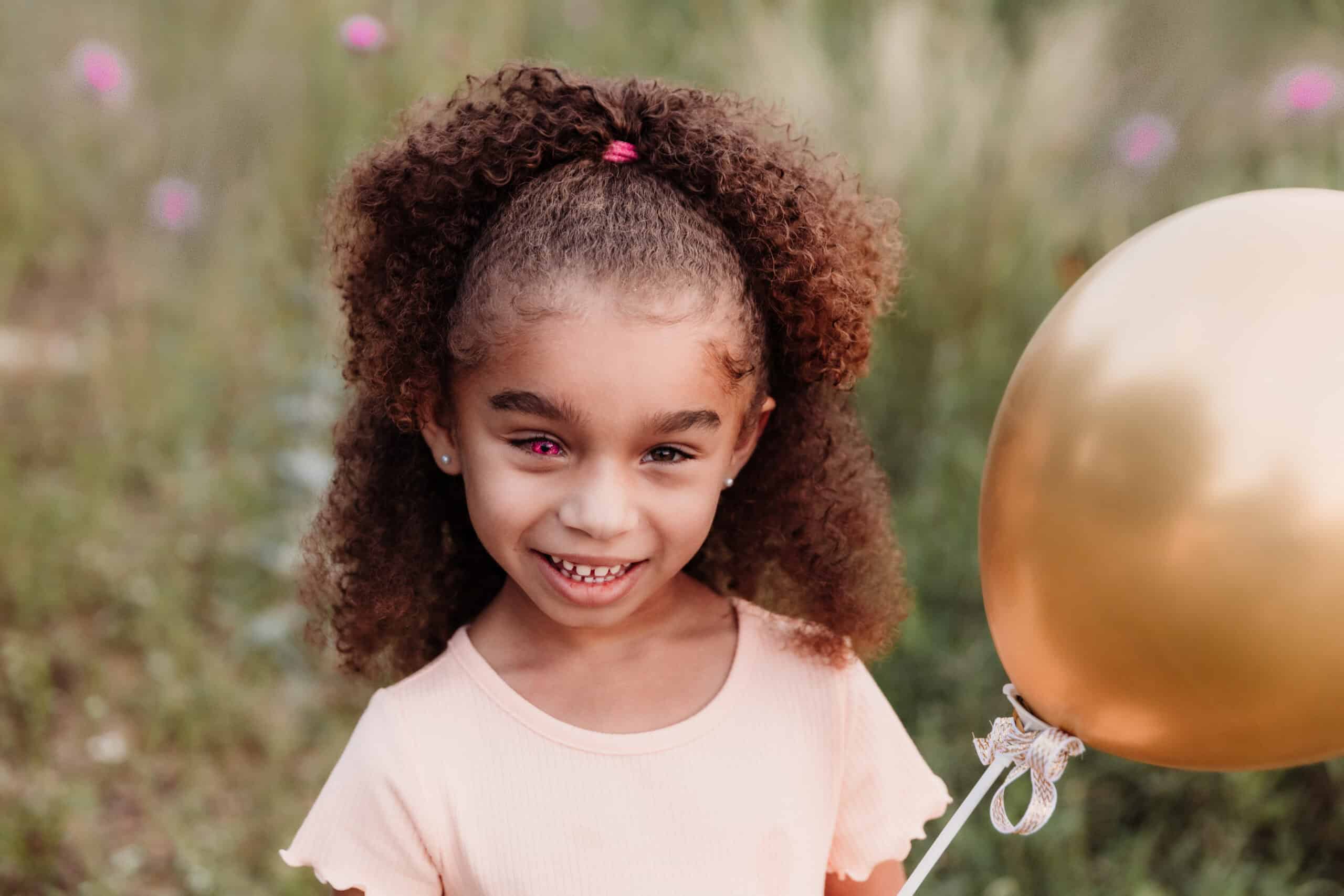 Meet Ayla – Bilateral Retinoblastoma