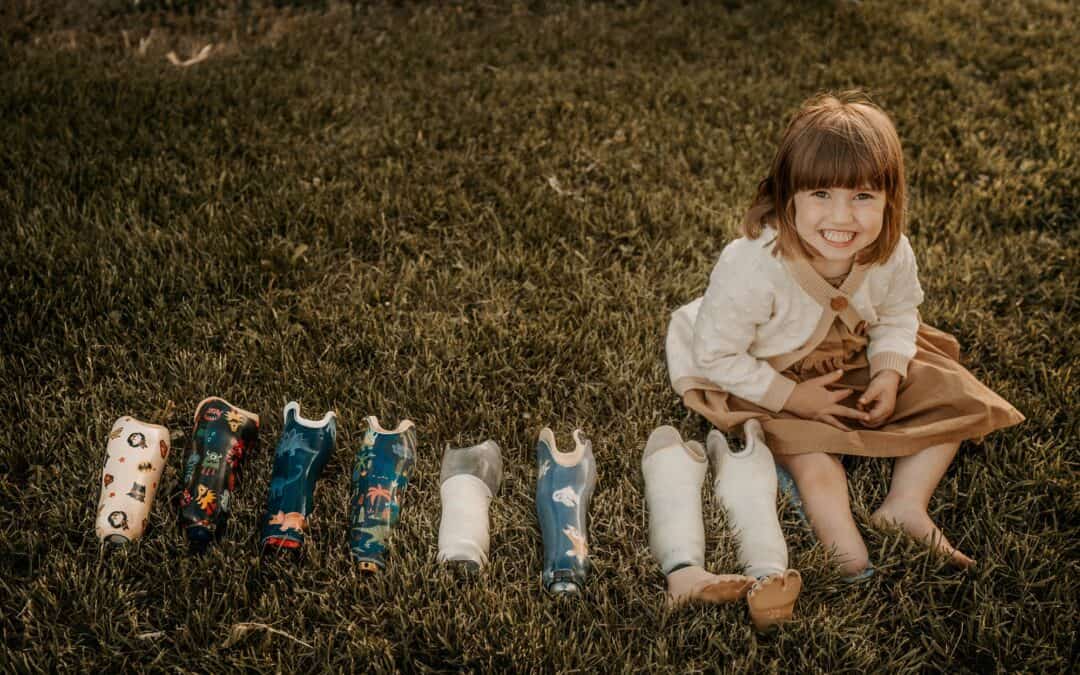 Meet Scarlet – Infantile Fibrosarcoma